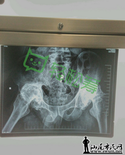 ΢Žͼ_20160513092228.png