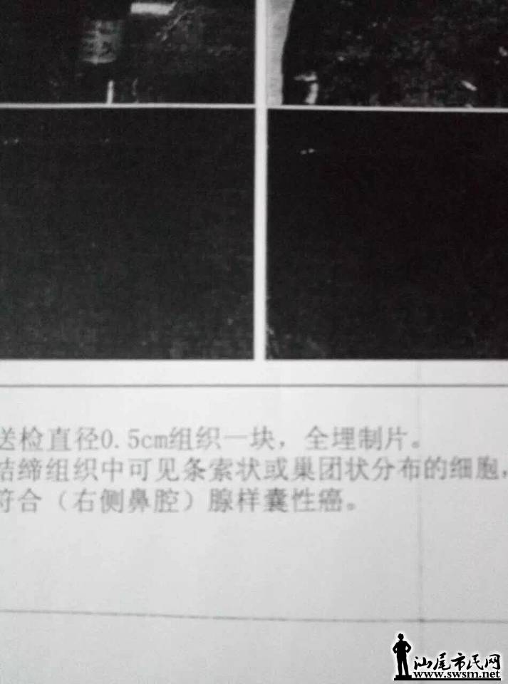 235613ncrdoyk0fvd1ed8a.jpg