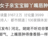 ��������Ӥ����Ѿ���촽�������㳦��ҽ����Ӥ���Ų����д���΢����