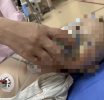 1�걦����Ͷ����ʳ�õļ�����ע������ҩ��ҽԺ����3�β�Σ֪ͨ�飬���Ӱְַ���
