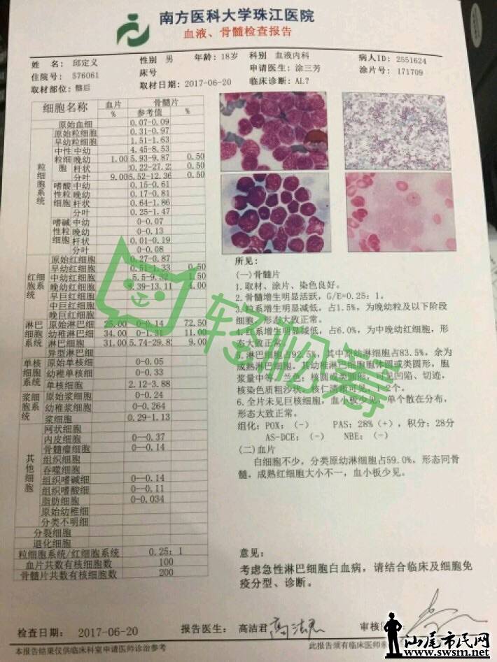 wechat_upload1499830514596598f2bea85